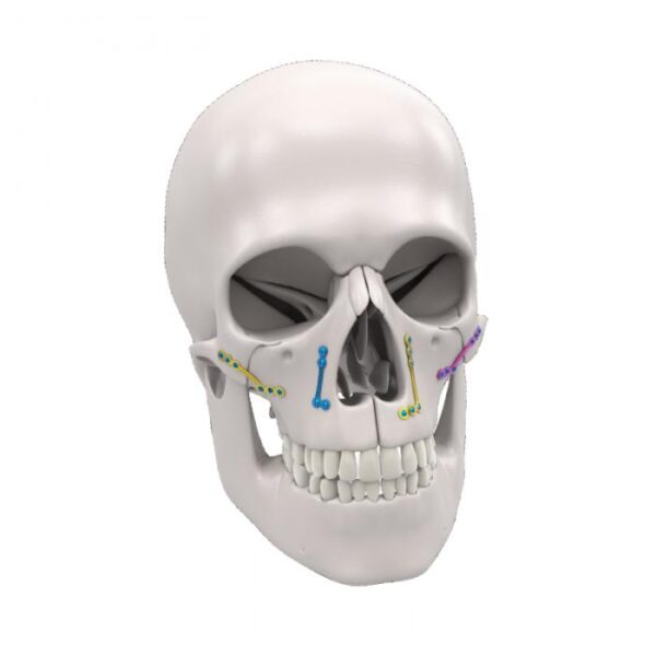 Système de fixation orthognathique
