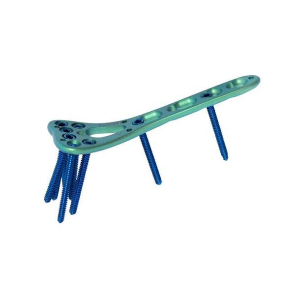 Plaque de verrouillage du radius distal Ⅰ