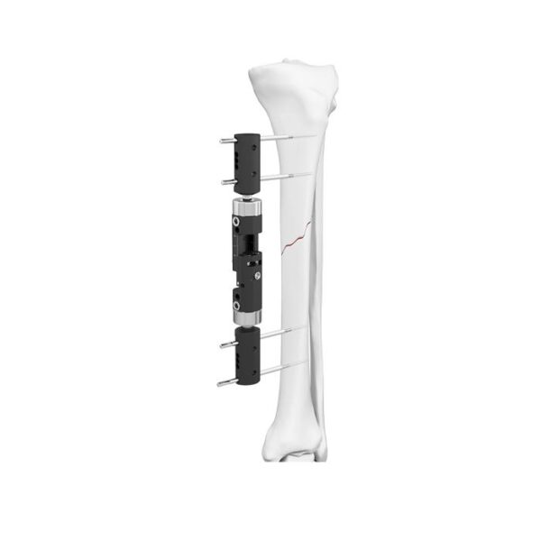 Fixateur externe dynamique