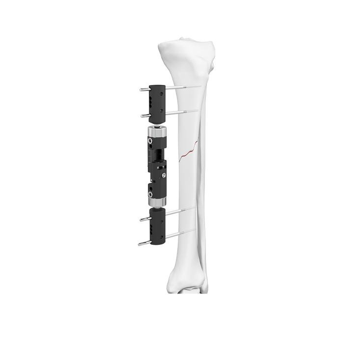 Fixateur externe dynamique