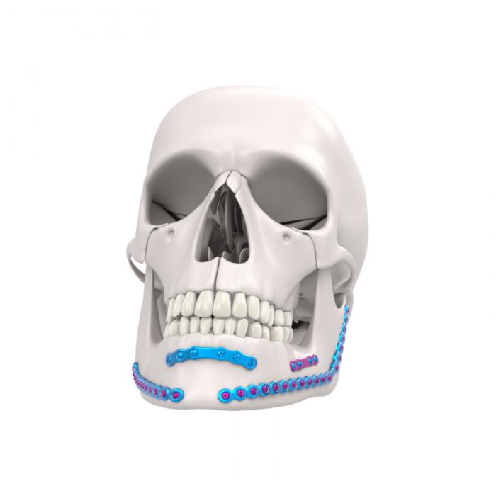 Système de fixation de la mandibule