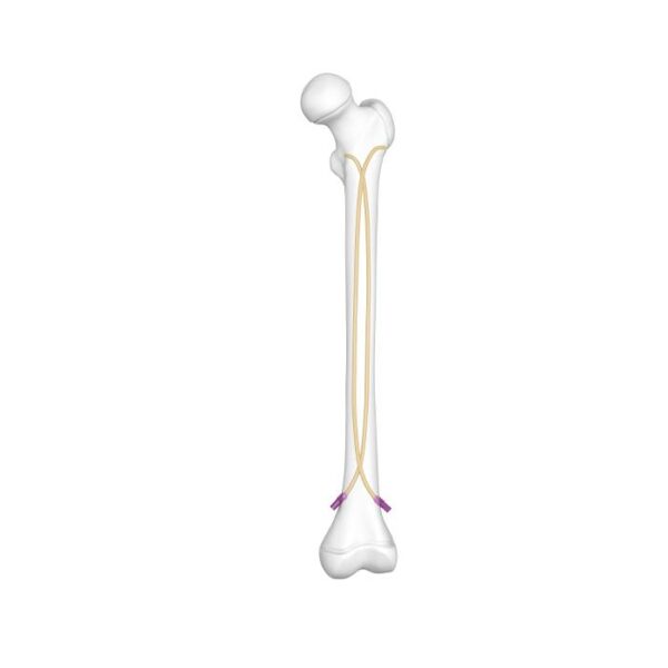 Ongle élastique en titane