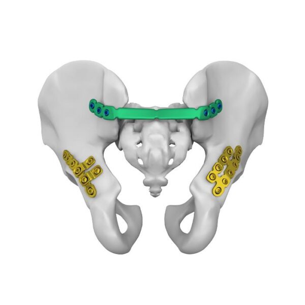 Ces plaques anatomiquement profilées pour l'omoplate constituent un excellent choix pour traiter différents types de fractures de l'omoplate.